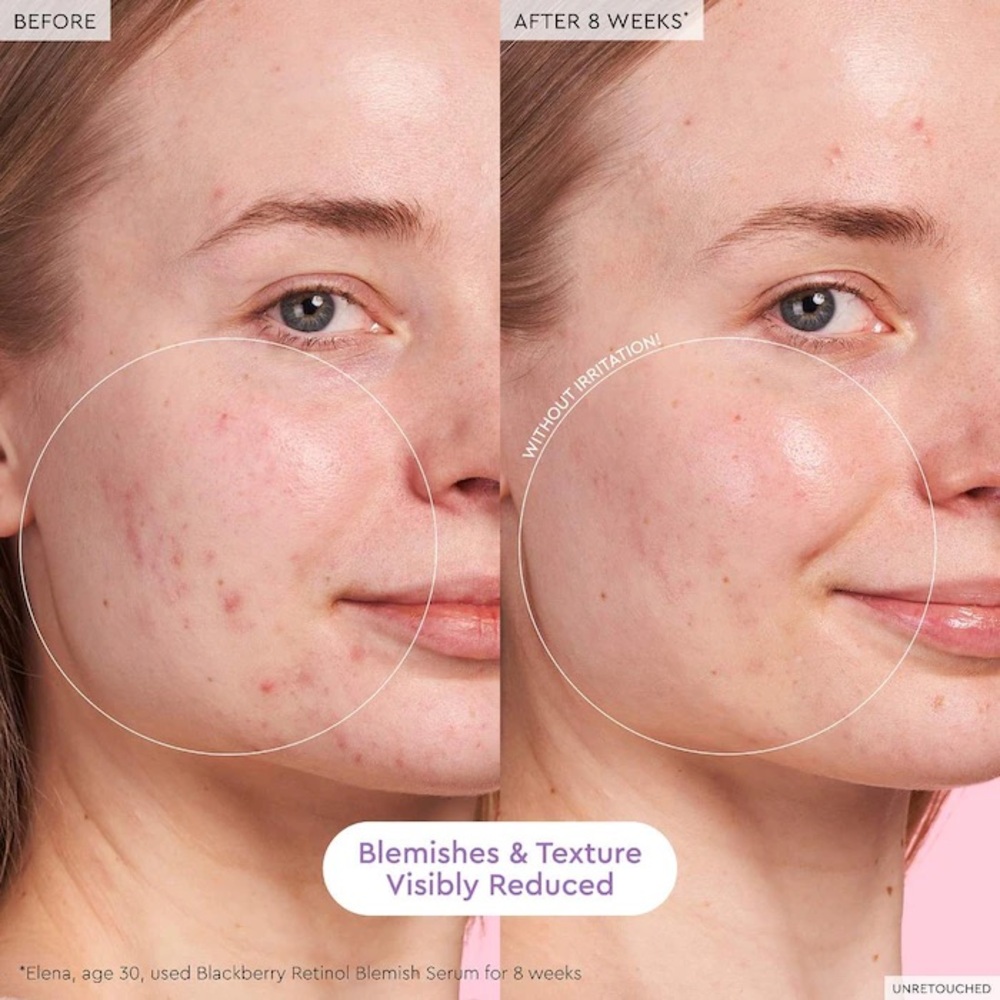 3/$50 💫 Glow Recipe 
Blackberry Retinol Blemish Serum 1oz - Picture 3 of 8